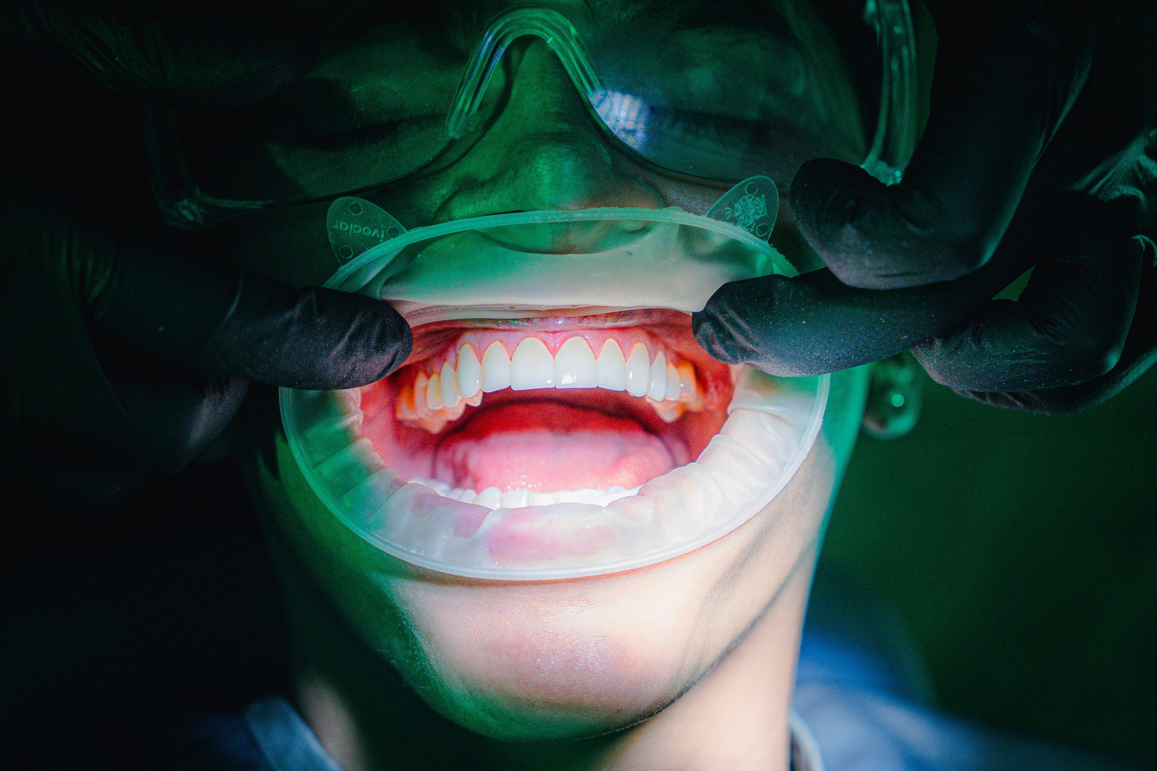 Estética Dental